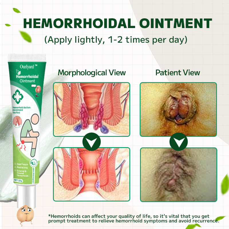 Ourlyard™ Hemorrhoidal Ointment